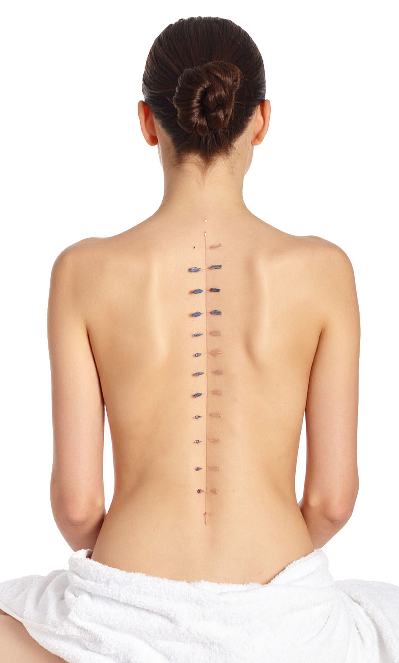 Akupunktur01 Akupunktur beim Frauenarzt Dr. Lang